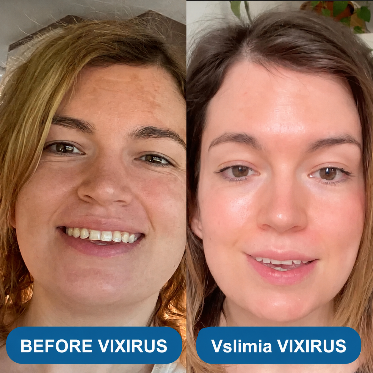 ✅Youthful Looking Skin in 30 Days-VIXIRUS® 3% Hyaluronic Acid Ultra Hydrating Serum Deep Hydration. Fresh Glow.