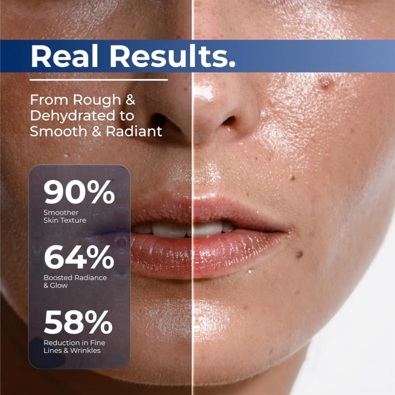 ✅Youthful Looking Skin in 30 Days-VIXIRUS® 3% Hyaluronic Acid Ultra Hydrating Serum Deep Hydration. Fresh Glow.