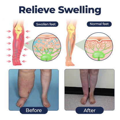 VIXIRUS® SwellRelief Circulation Support Cream