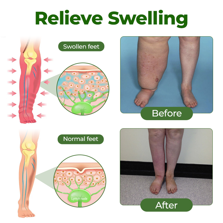✨Vixirus™ Professional Leg Circulation Cream Advanced Botanical Formula for Light Comfortable Legs🦵