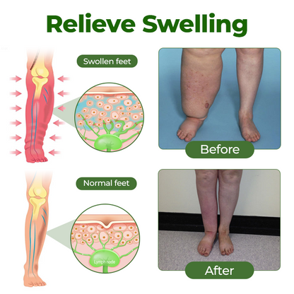 ✨Vixirus™ Professional Leg Circulation Cream Advanced Botanical Formula for Light Comfortable Legs🦵