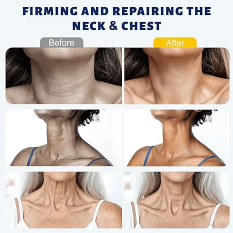 ✨ VIXIRUS™ Instant Neck Lift Cream — 🧴 Infused with Retinol & Hyaluronic Acid | Firms the Neck, Reduces Wrinkles & Double Chin