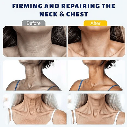 ✨ VIXIRUS™ Instant Neck Lift Cream — 🧴 Infused with Retinol & Hyaluronic Acid | Firms the Neck, Reduces Wrinkles & Double Chin