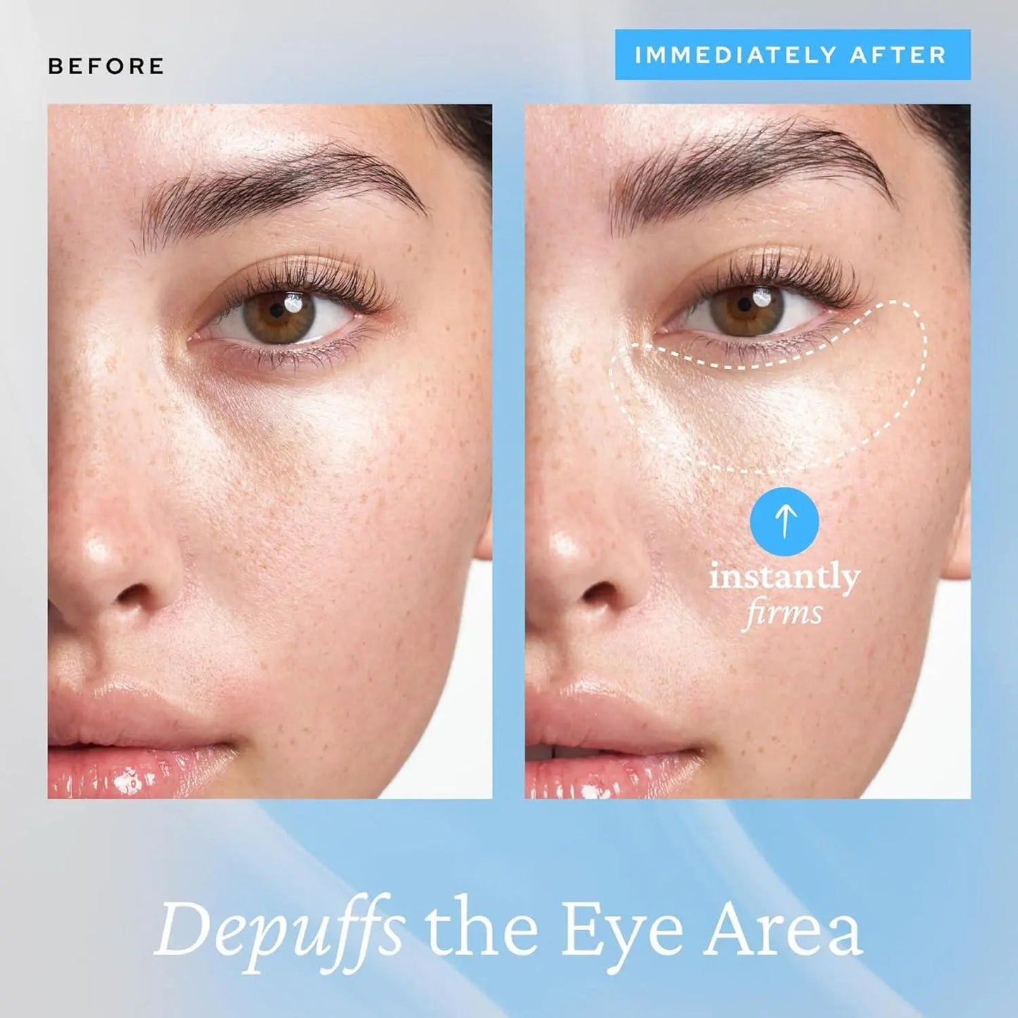 Eye Gel, Korean Skincare with Caffeine, Hyaluronic Acid & Niacinamide – Hydrating, Depuffing & Plumping Eye Cream with Cooling Ceramic Tip