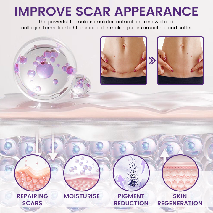 VIXIRUS® Stem Cell Scar Gel