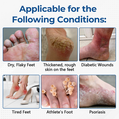 VIXIRUS® PureFoot Diabetes Treatment Stick