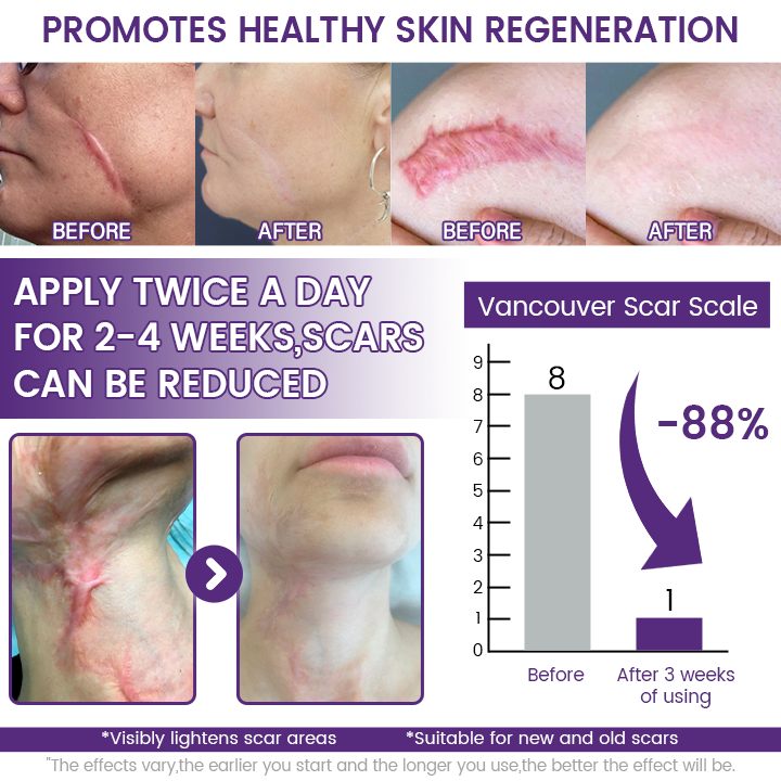 VIXIRUS® Stem Cell Scar Gel