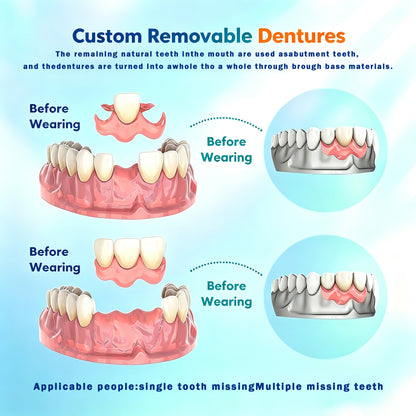 👑Ends Today: 70% OFF! ⏰VIXIRUS™ Medical Full Denture with  Strong Suction🦷Obtain Dental Association Certification