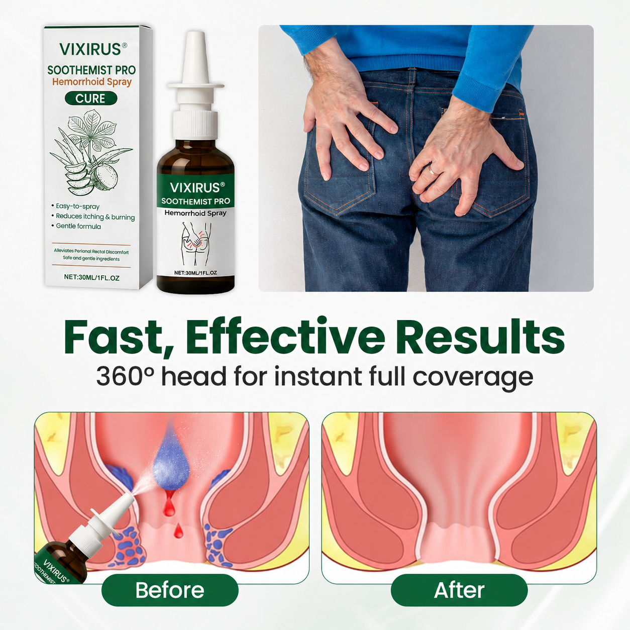 VIXIRUS® SootheMist PRO Hemorrhoid Spray