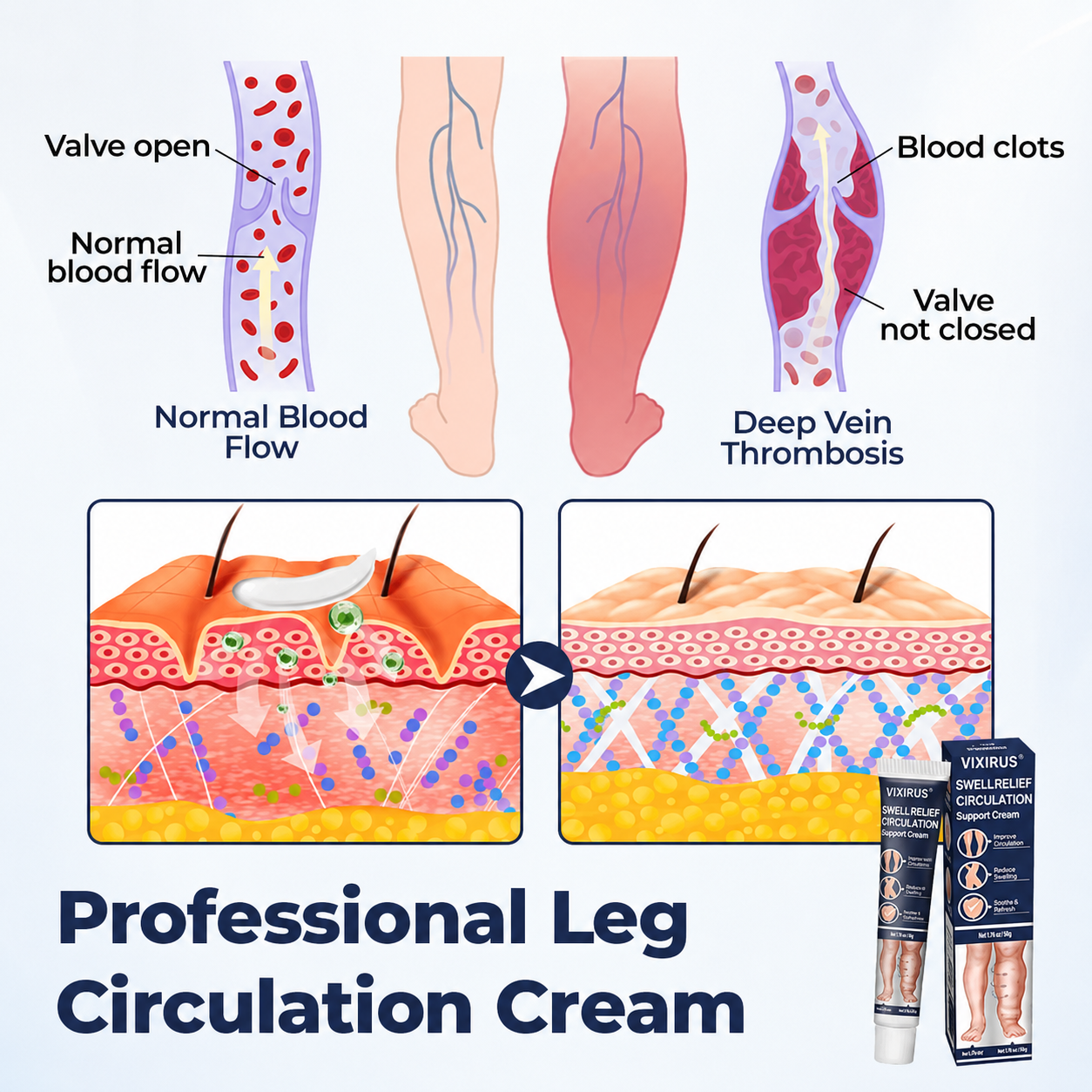 VIXIRUS® SwellRelief Circulation Support Cream