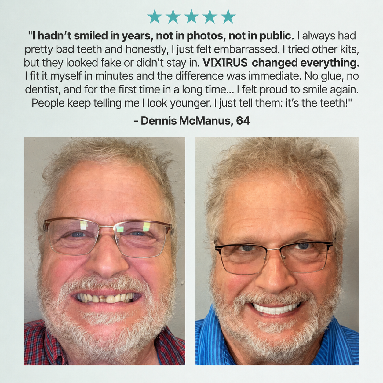 🌎Ends Today: 70% OFF! ⏰VIXIRUS™ Medical Full Denture with Strong Suctiond🦷Obtain American Dental Association (ADA) Certification