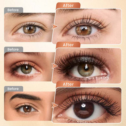 VIXIRUS Eyelash Growth Serum- Safe & Gentle Lashes Care, Fuller, Thicker in 2 Weeks, Non-Prostaglandin