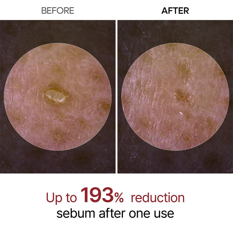VIXIRUS®--Rice  Peel Shot Serum