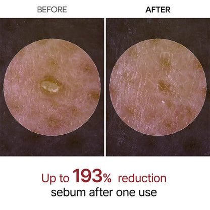 VIXIRUS®--Rice  Peel Shot Serum