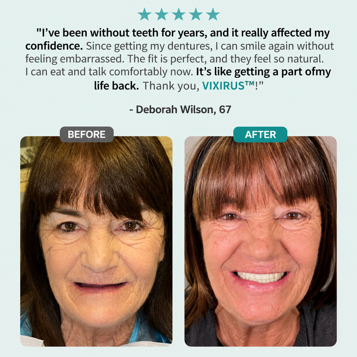 🦷VIXIRUS® Medical Full Denture with Strong Suction ✅ Made and Shipped from the（USA）