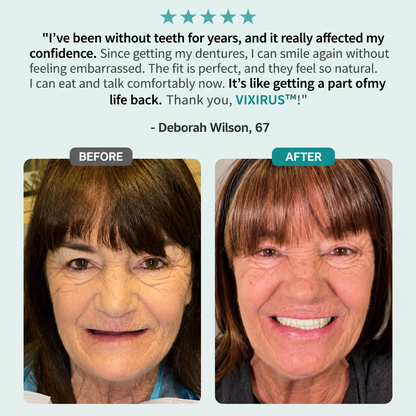 🦷VIXIRUS® Medical Full Denture with Strong Suction ✅ Made and Shipped from the（USA）