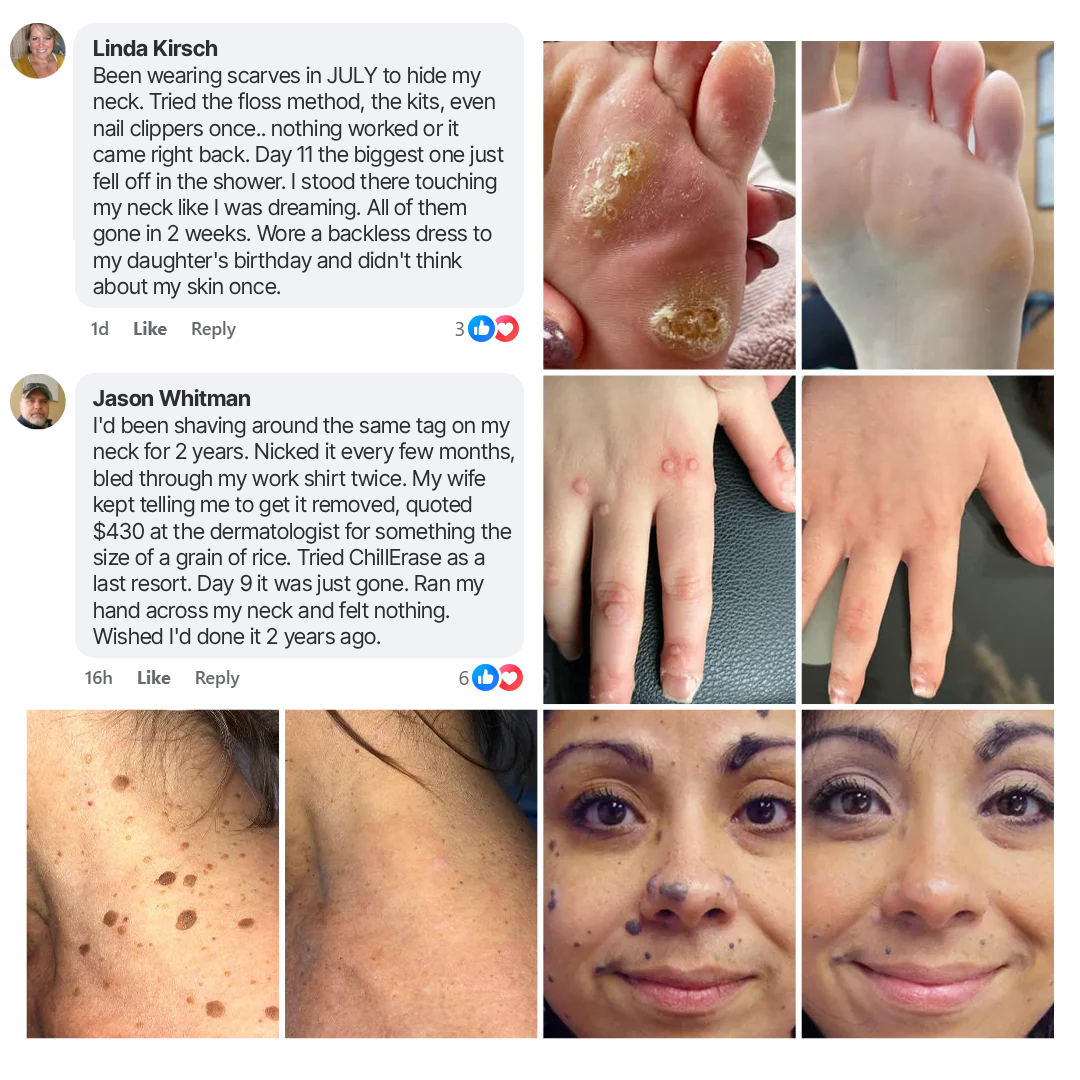 VIXIRUS® Bump Renewal Spray
