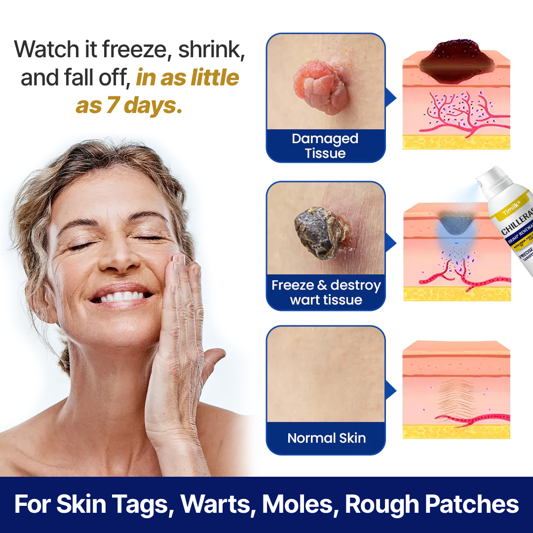 VIXIRUS® Bump Renewal Spray