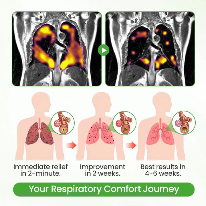 ❣️✅UK Owned and Operated|VIXIRUS® Botanical Mullein Lung Cleanse Diffuser (💝 Cough, wheezing, shortness of breath, sputum, stuffy nose, bronchitis, bronchitis, allergy symptoms, lung discomfort💝)