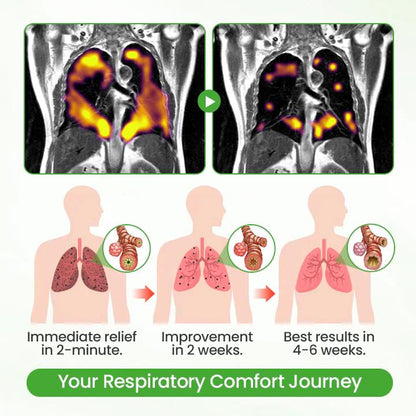 ❣️✅UK Owned and Operated|VIXIRUS® Botanical Mullein Lung Cleanse Diffuser (💝 Cough, wheezing, shortness of breath, sputum, stuffy nose, bronchitis, bronchitis, allergy symptoms, lung discomfort💝)